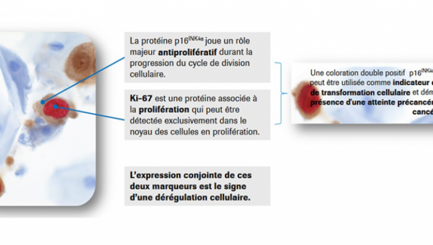 cintec plus